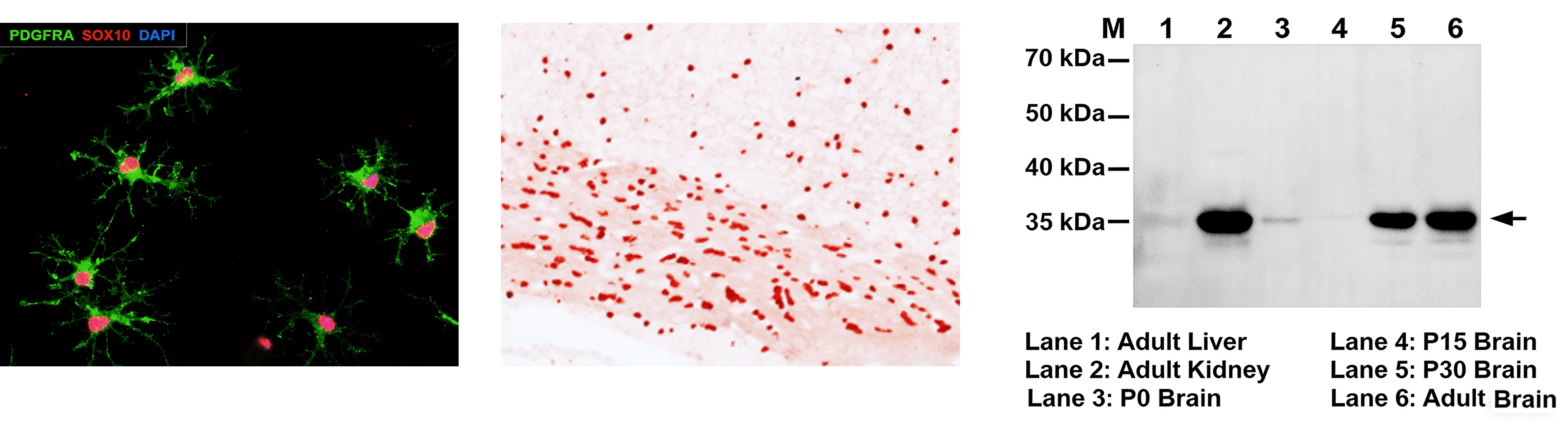 polyclonal antibodies case study